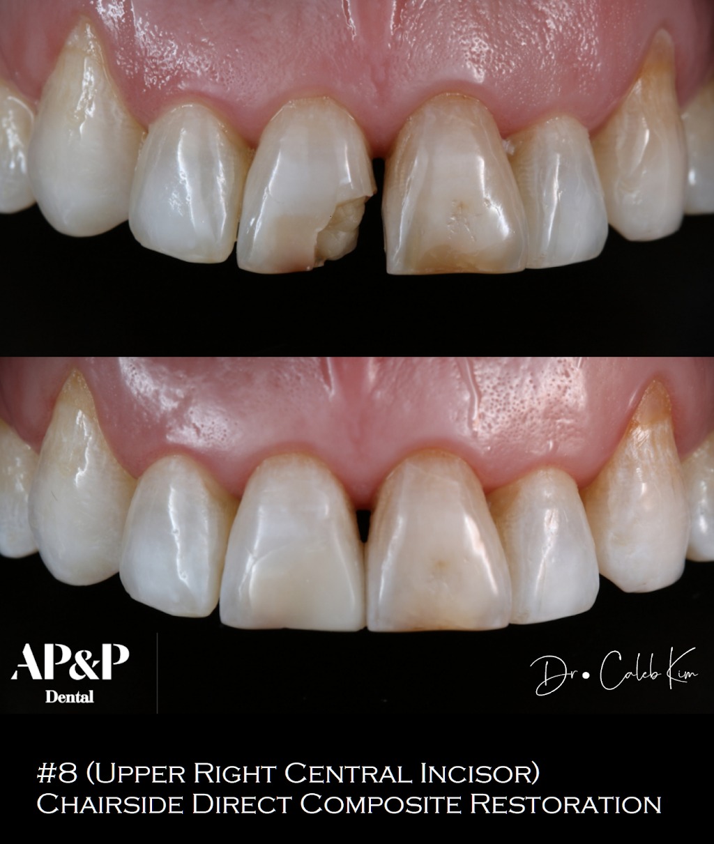 AP&P Dental - Advanced Prosthodontics & Periodontics | 119 1st St STE 2, Ho-Ho-Kus, NJ 07423, USA | Phone: (201) 652-7711