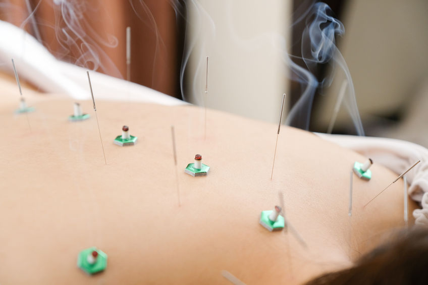 EastOne Acupuncture | 4951 Lincoln Ave, Cypress, CA 90630, USA | Phone: (562) 292-7572