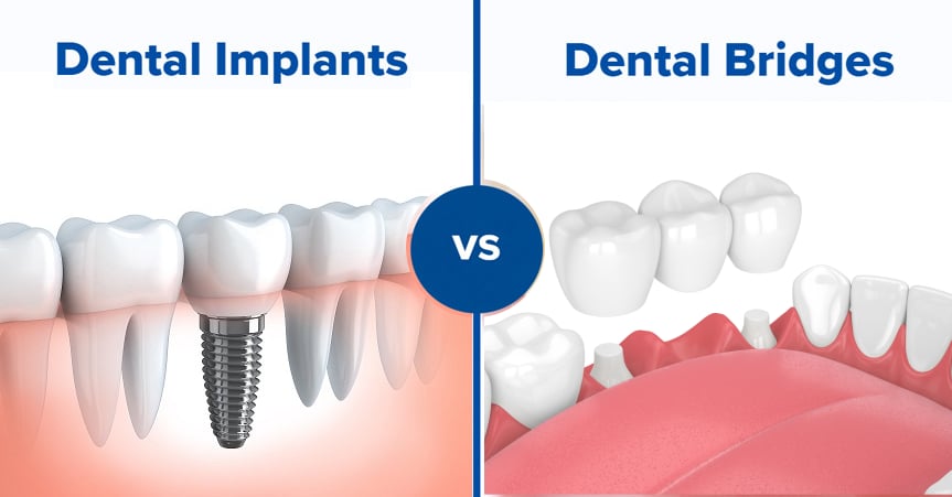 Fresh Family Dental | 355 E Westchester Pkwy Suite 200, Grand Prairie, TX 75052, USA | Phone: (972) 546-3888