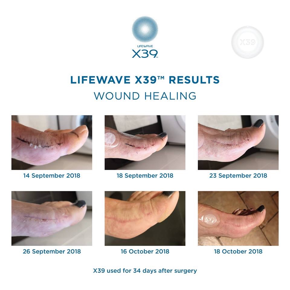 LifeWave x39 Natural Health Revolution | 2600 Scandia Ct, Modesto, CA 95358, USA | Phone: (209) 652-2257