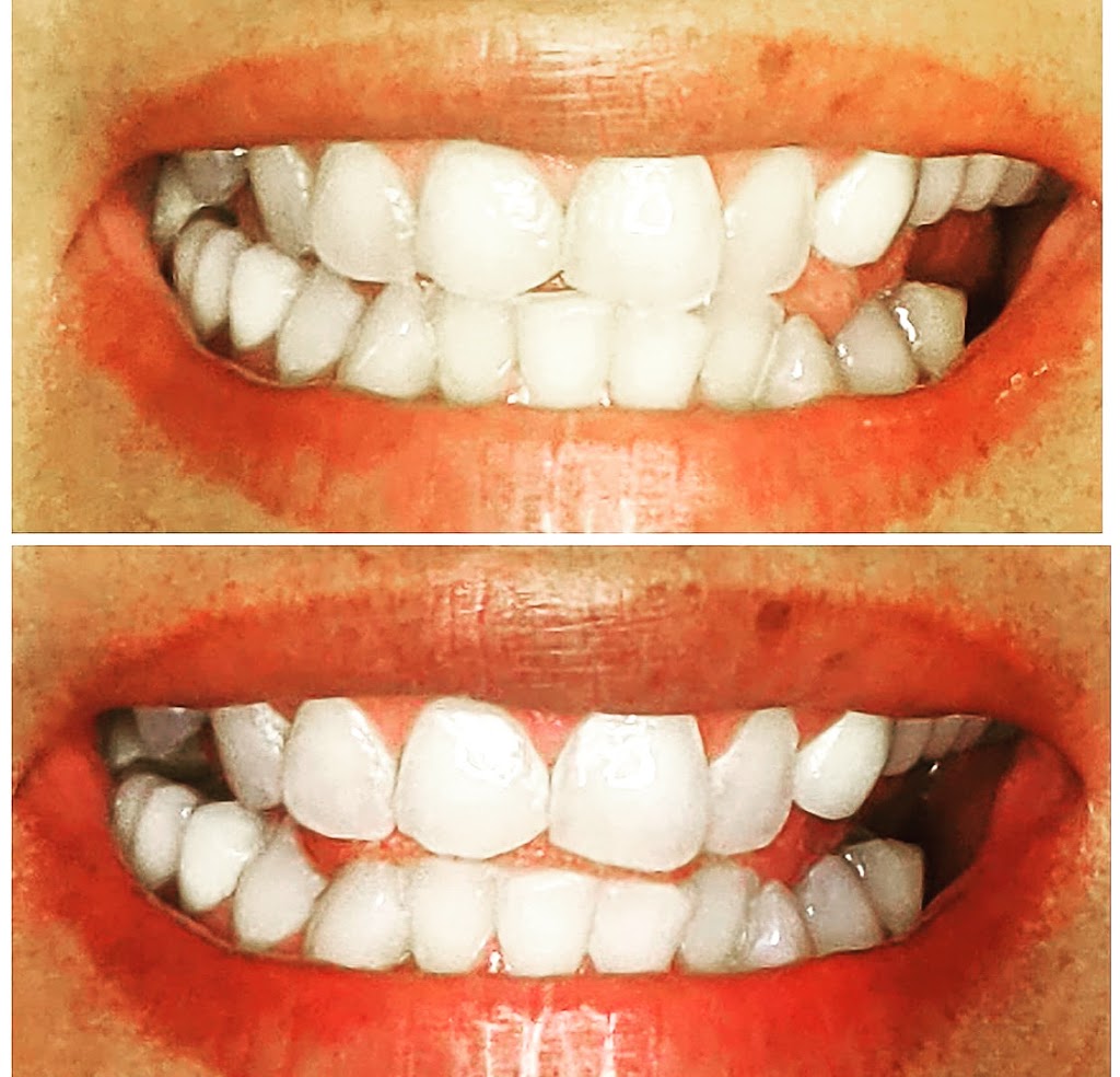 Goddess 1 Teeth Whitening LLC | 24630 Washington Ave STE 202, Murrieta, CA 92562, USA | Phone: (951) 251-5176