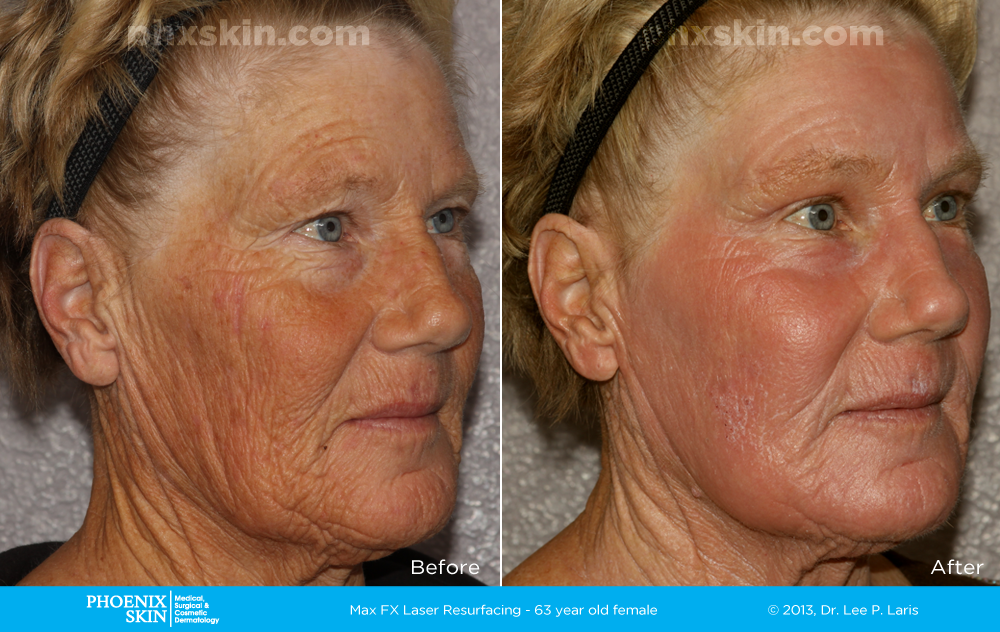 Phoenix Skin Medical Surgical Group | 7312 E Deer Valley Rd #105, Scottsdale, AZ 85255, USA | Phone: (480) 473-9111