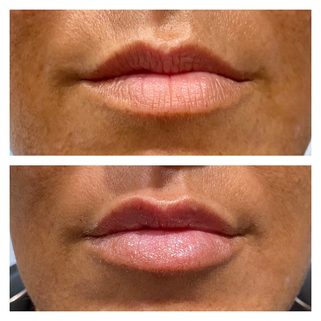 BOTOX ®/ FILLERS /brēT͟H/ Aesthetics | 1650 Nashville Pike Suite 600, Gallatin, TN 37066, USA | Phone: (615) 906-2249