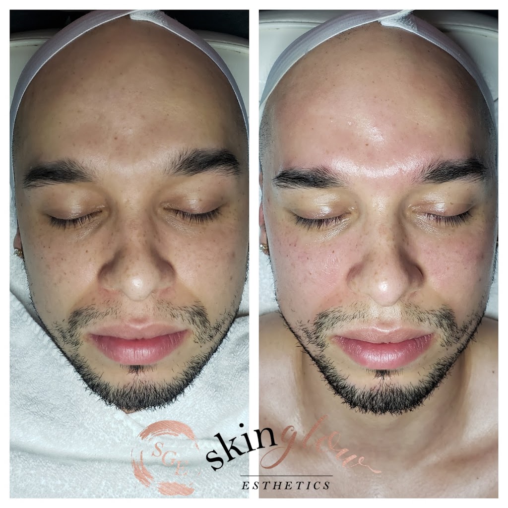 Skin Glow Esthetics | 380 Lowell St Suite 202B, Wakefield, MA 01880, USA | Phone: (978) 882-2833