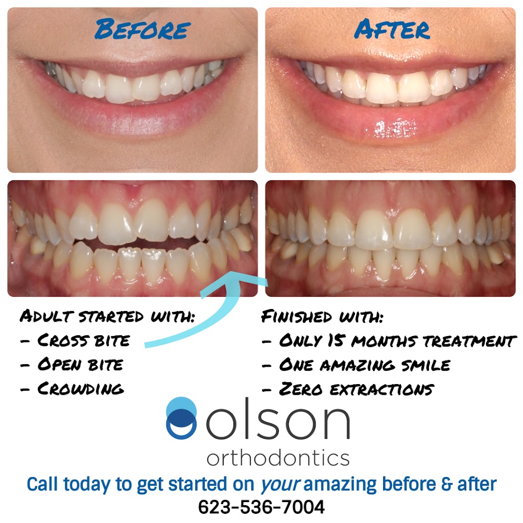 Olson Orthodontics - Chris Olson, DDS, MS | 13575 W Indian School Rd STE 400, Litchfield Park, AZ 85340, USA | Phone: (623) 536-7004