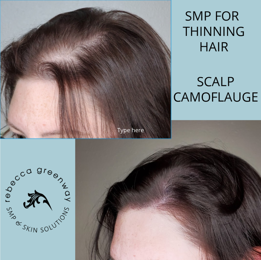 SMP & Skin Solutions | 111 SE Everett Mall Way Bldg F, Everett, WA 98208, USA | Phone: (425) 441-7840