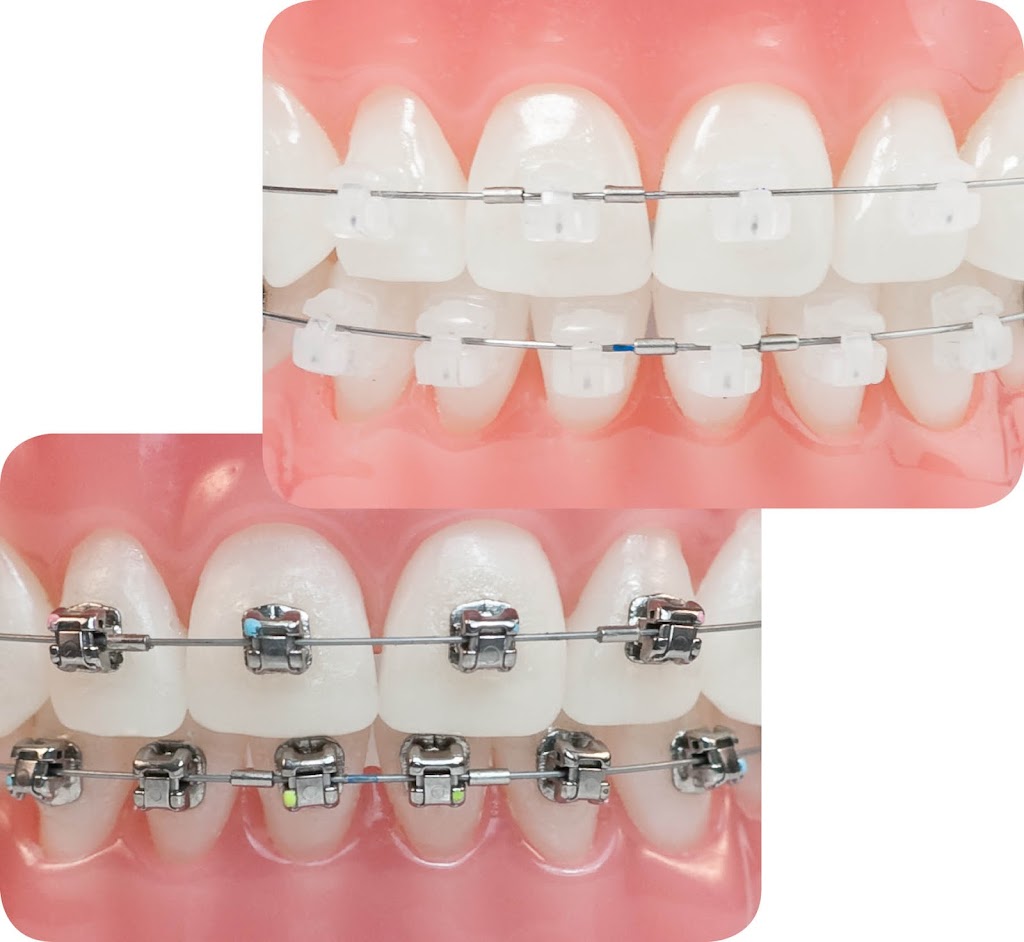 Irving Orthodontics | 3636 N MacArthur Blvd #100, Irving, TX 75062, USA | Phone: (972) 258-0758