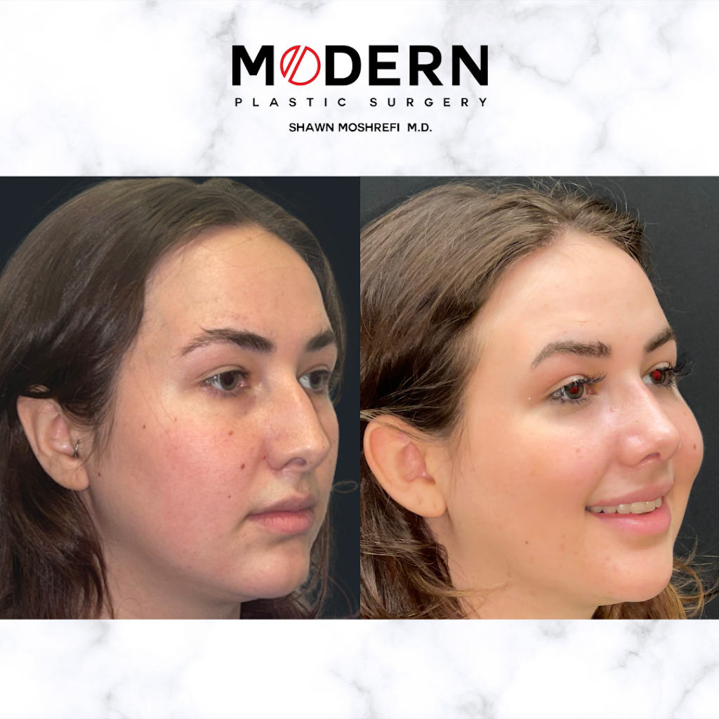 Modern Plastic Surgery: Dr. Shawn Moshrefi, M.D. | 24100 Calabasas Rd, Calabasas, CA 91302, USA | Phone: (818) 823-0655