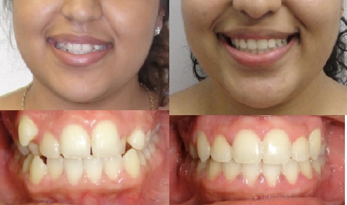 iCare Orthodontics | 97-16 Metropolitan Ave, Queens, NY 11375, USA | Phone: (718) 846-4400