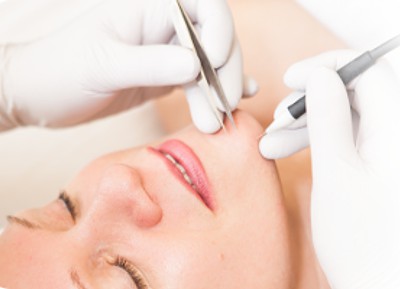 Electrolysis By Linda Rydman | 2555 Enterprise Rd # 11-2, Clearwater, FL 33763, USA | Phone: (727) 796-1503