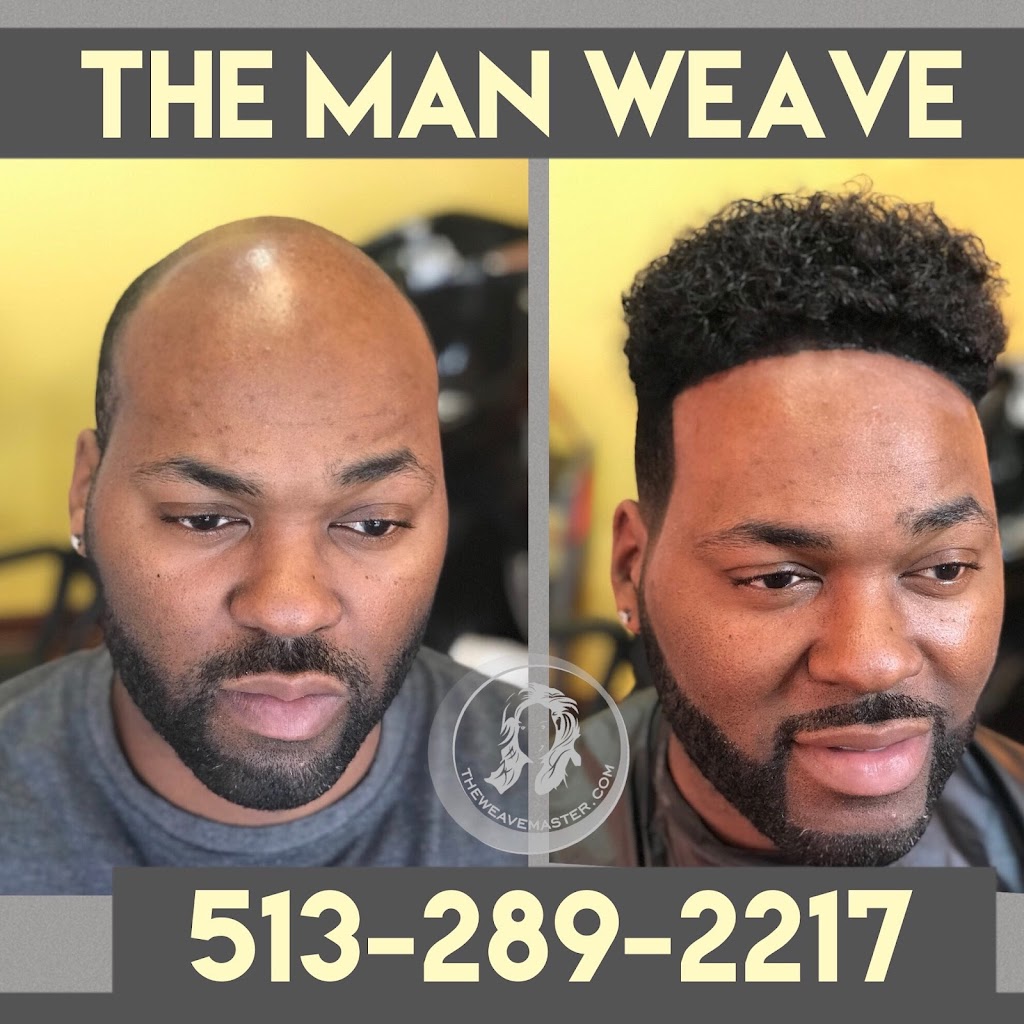 Transformations Hair Restoration Inc. | 32 Triangle Park Dr, Cincinnati, OH 45246, USA | Phone: (513) 824-8648