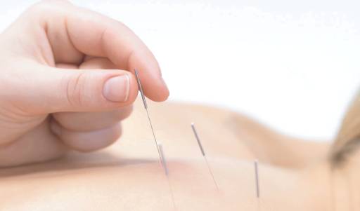 88 Acupuncture Clinic | 650 Mowry Ave, Fremont, CA 94536, USA | Phone: (408) 306-4118