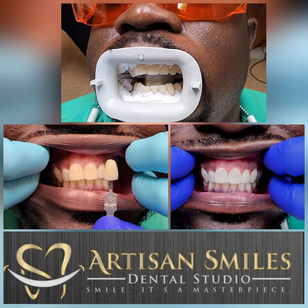 Artisan Smiles Dental Studio | 2613 A, 2613 B, 2613 W Mercury Blvd, Hampton, VA 23666, USA | Phone: (757) 826-7372