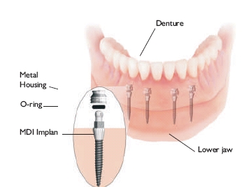 Liberty Dental Clinic | Av. Francisco I. Madero 8251, Zona Centro, 22000 Tijuana, B.C., Mexico | Phone: (619) 308-7948