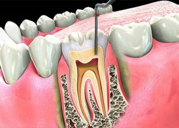 Dr. Tsolakyans Dental Wellness Center | 3161 Los Feliz Blvd, Los Angeles, CA 90039, USA | Phone: (323) 663-2606