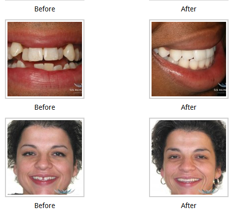 Vaisman Anatoly DDS | 11273 Laurel Canyon Blvd, San Fernando, CA 91340, USA | Phone: (818) 365-7191