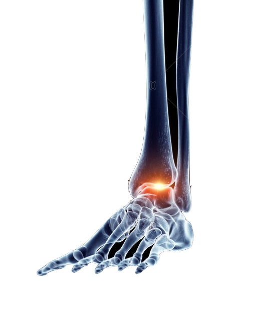 Revive Foot & Ankle Center | 22110 Roscoe Blvd # 201, West Hills, CA 91304, USA | Phone: (800) 698-5064