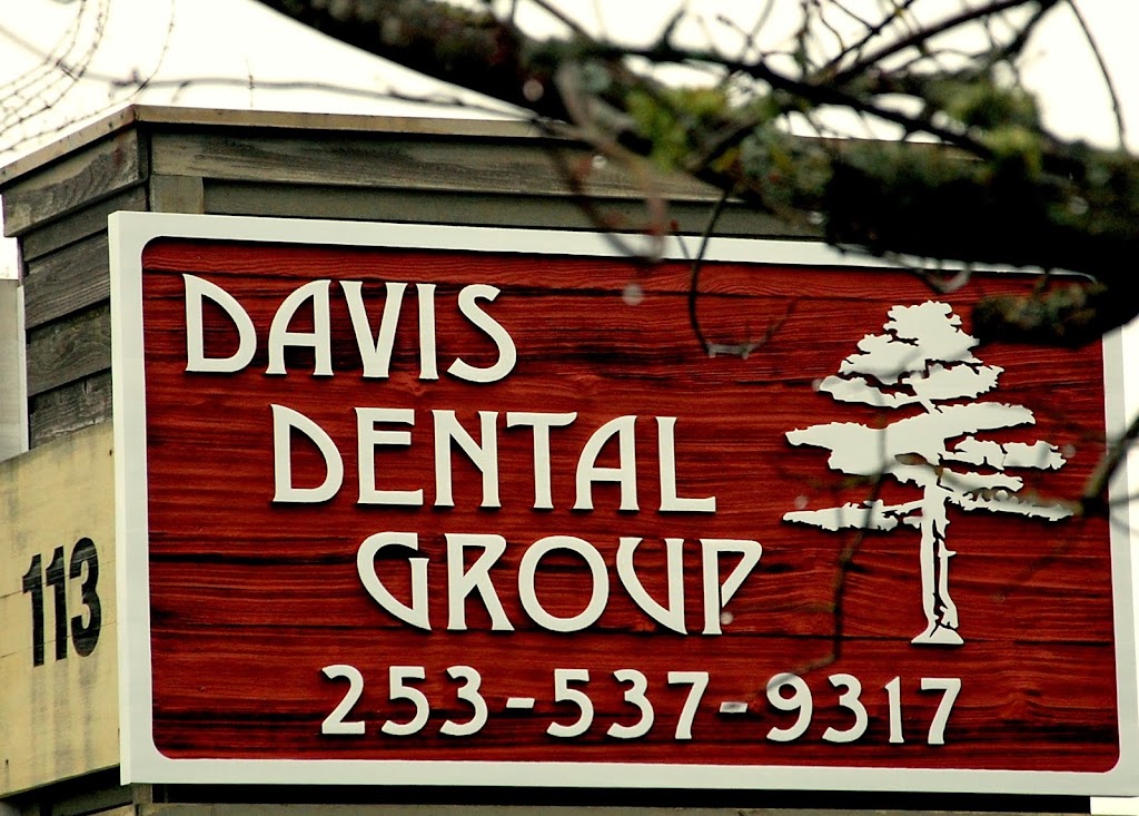 Davis John M DDS | 113 132nd St S, Tacoma, WA 98444, USA | Phone: (253) 537-9317