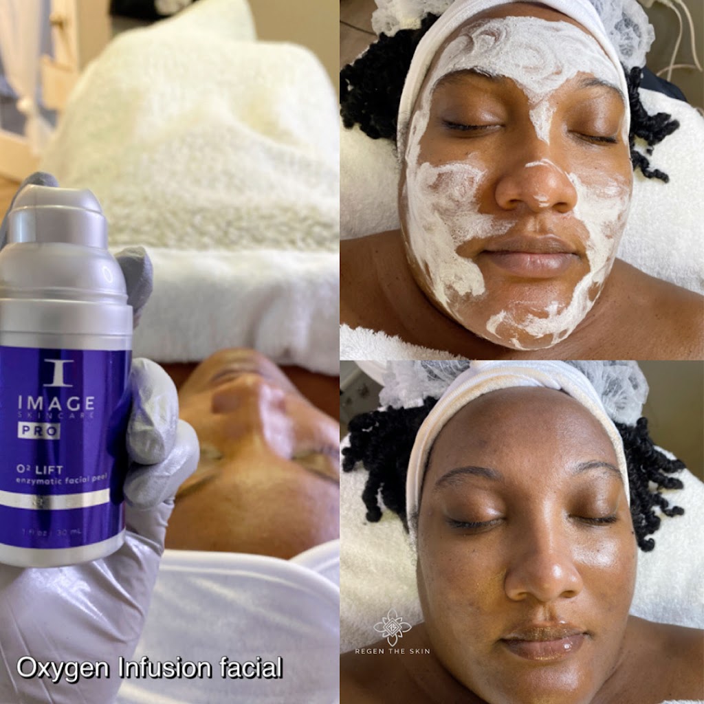 Regen The Skin | 2485 Old Washington Rd, Waldorf, MD 20601, USA | Phone: (240) 412-3096