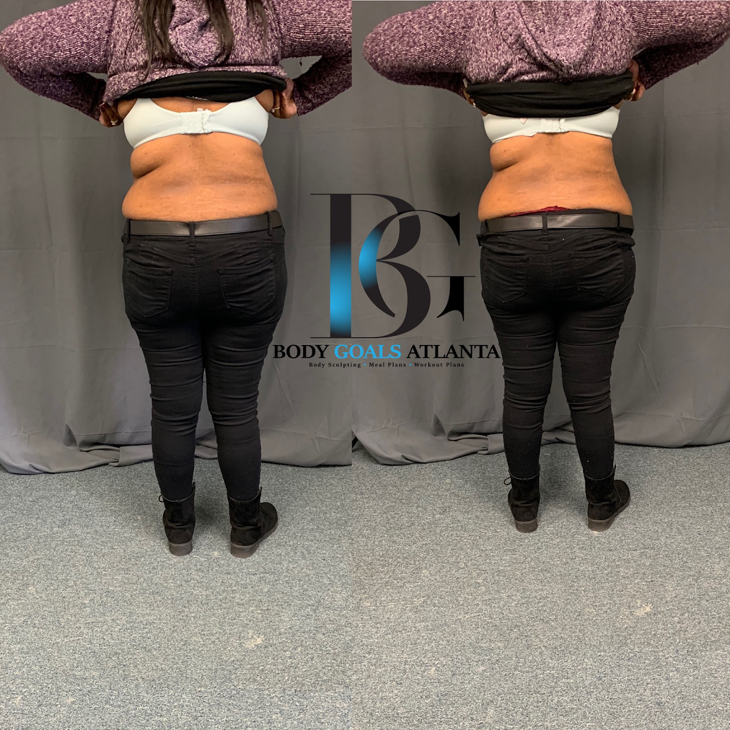 Body Goals Atlanta | 6755 Peachtree Industrial Blvd STE 215, Atlanta, GA 30360 | Phone: (404) 263-5881