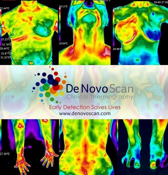 De Novo Scan, Clinical Thermography | 5949 E University Dr, Mesa, AZ 85205 | Phone: (480) 284-2222