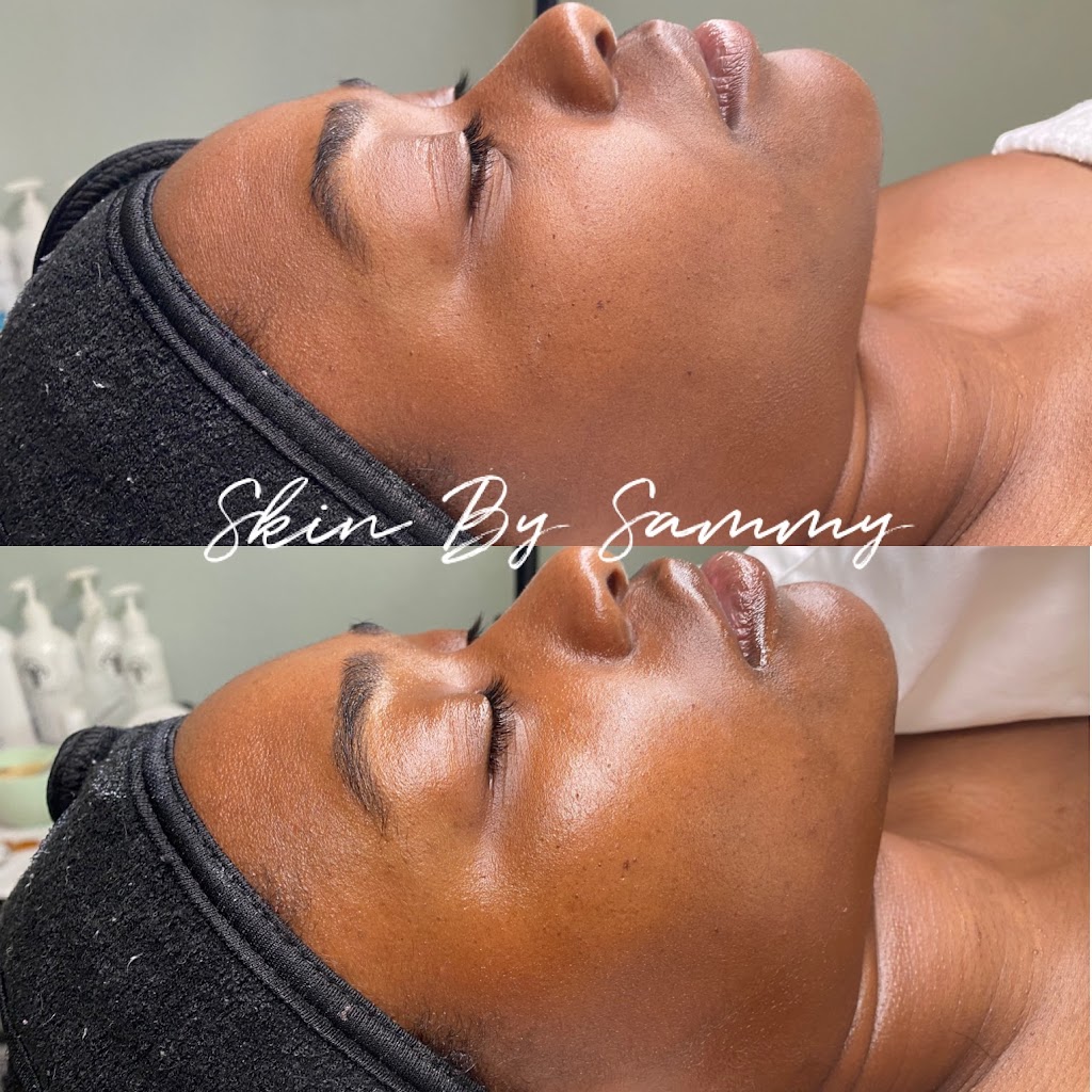 Skin By Sammy | 2918 Desert Pln Cv, Bradenton, FL 34211, USA | Phone: (815) 450-0589