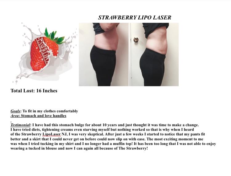 Strawberry LipoLaser NJ | 759 Broad St, Shrewsbury, NJ 07702 | Phone: (800) 875-5787