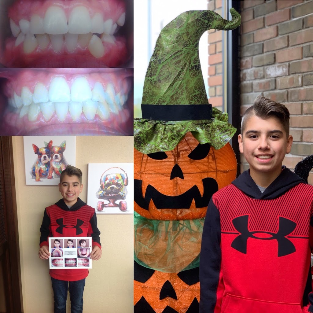 Finazzo Orthodontic Specialists | 12985 Northline Rd, Southgate, MI 48195, USA | Phone: (734) 285-8600