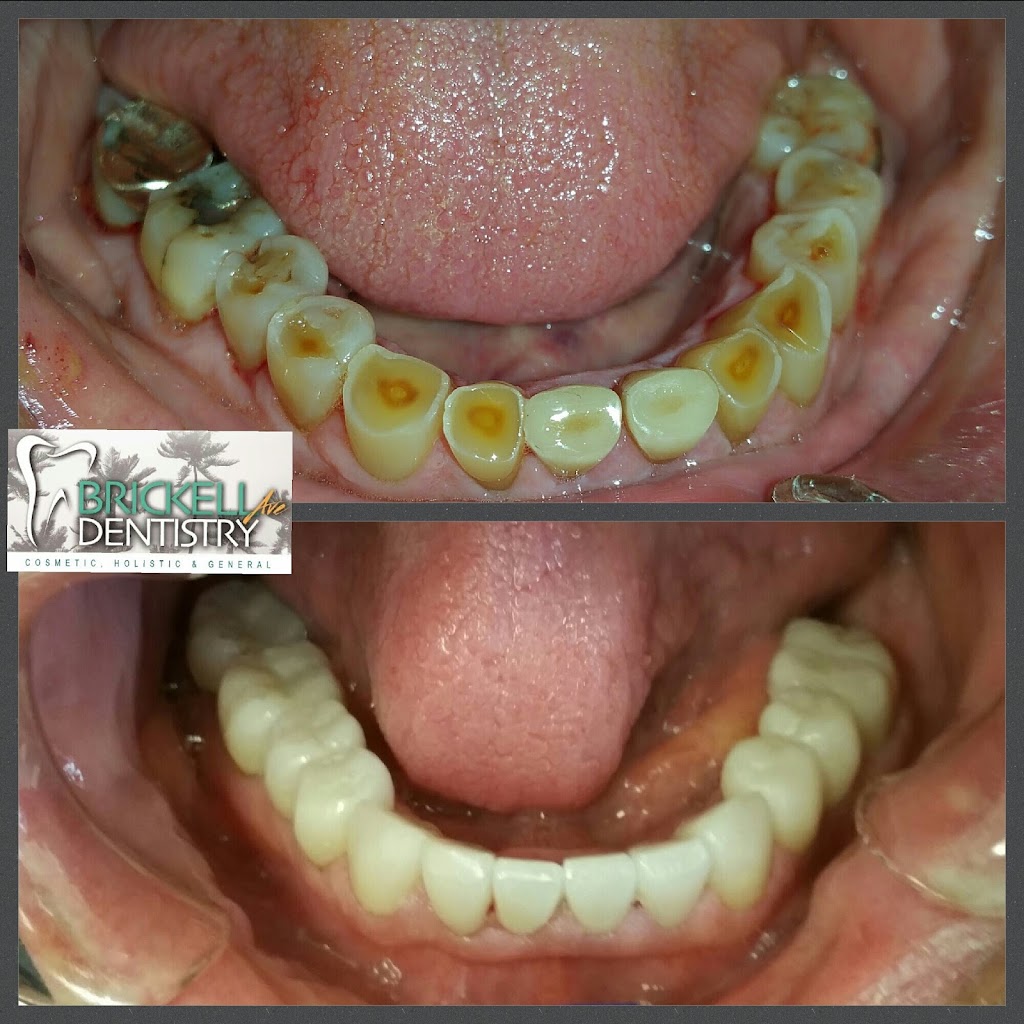 Dr. Abraham Jaskiel, DMD Dentist | 1865 Brickell Ave, Miami, FL 33129, USA | Phone: (305) 854-8084
