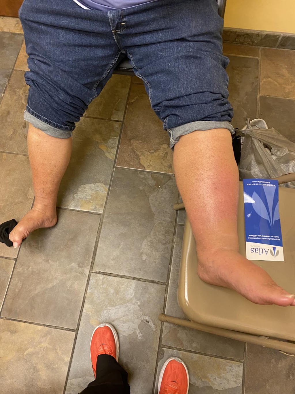 Richard P. Jacoby, DPM Foot & Ankle Surgeon | 1968 N Peart Rd Suite 102, Casa Grande, AZ 85122, USA | Phone: (480) 717-5011