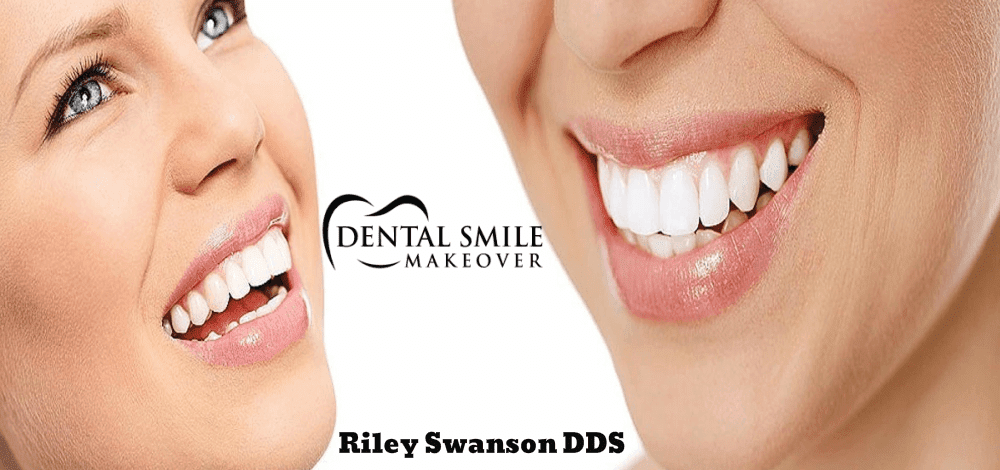 Dental Smile Makeover | 2090 Godby Rd, College Park, GA 30349, USA | Phone: (770) 991-0212