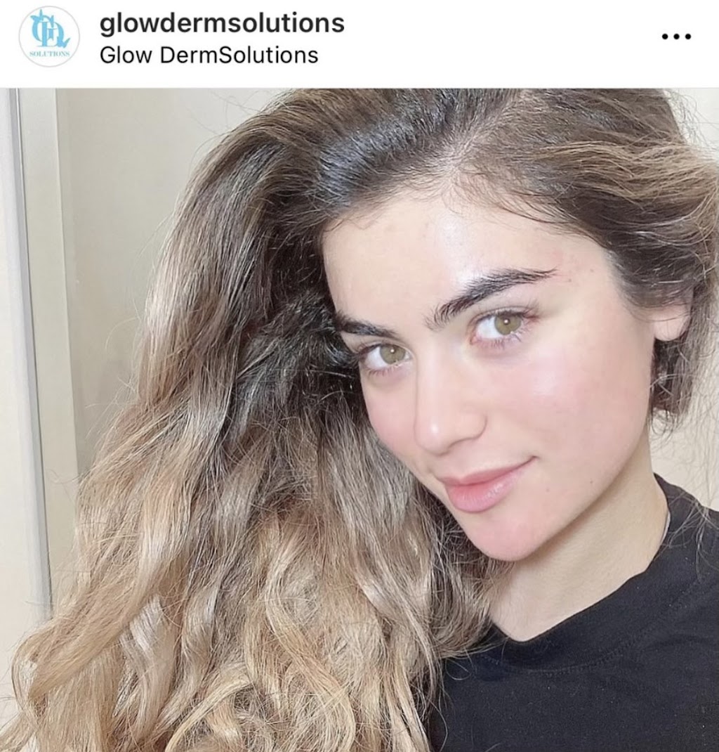 Glow DermSolutions San Jose | 6950 Santa Teresa Blvd STE E, San Jose, CA 95119, USA | Phone: (408) 794-5503 Glow DermSolutions San Jose | 6950 Santa Teresa Blvd STE E, San Jose, CA 95119, USA | Phone: (408) 794-5503