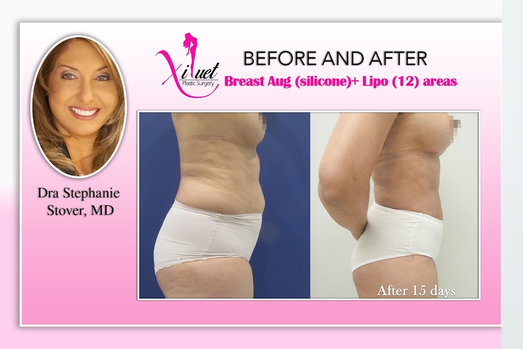 Dr. Stephanie A. Stover, MD | 8396 SW 8th St 1st floor, Miami, FL 33144, USA | Phone: (305) 615-4200