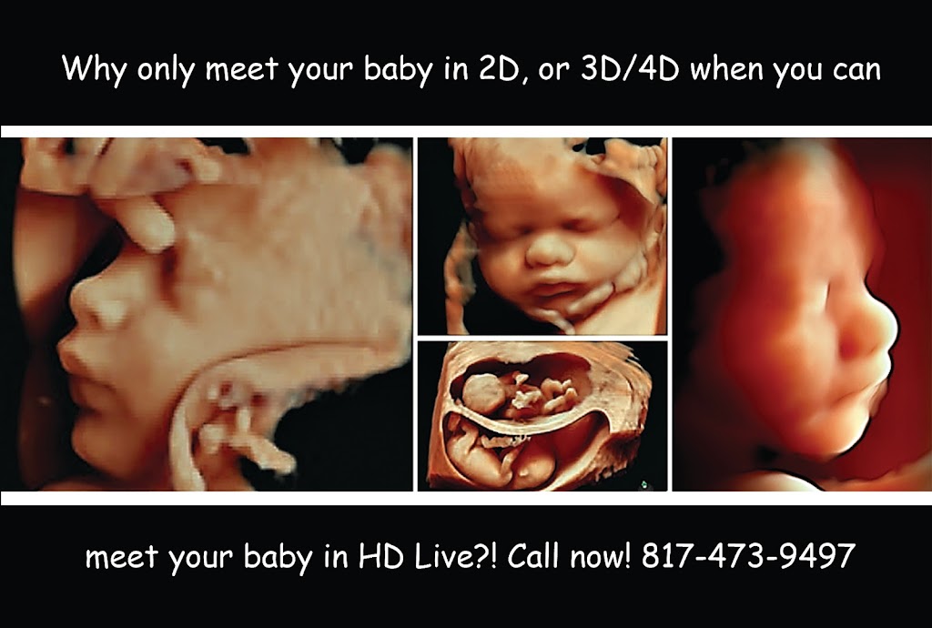 Baby View HD | 208 E Broad St, Mansfield, TX 76063, USA | Phone: (817) 368-1166