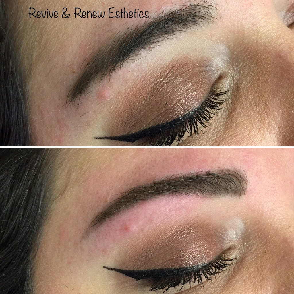 Revive & Renew Esthetics | 7711 East 111th St S Suite 121, Tulsa, OK 74133, USA | Phone: (918) 270-3602