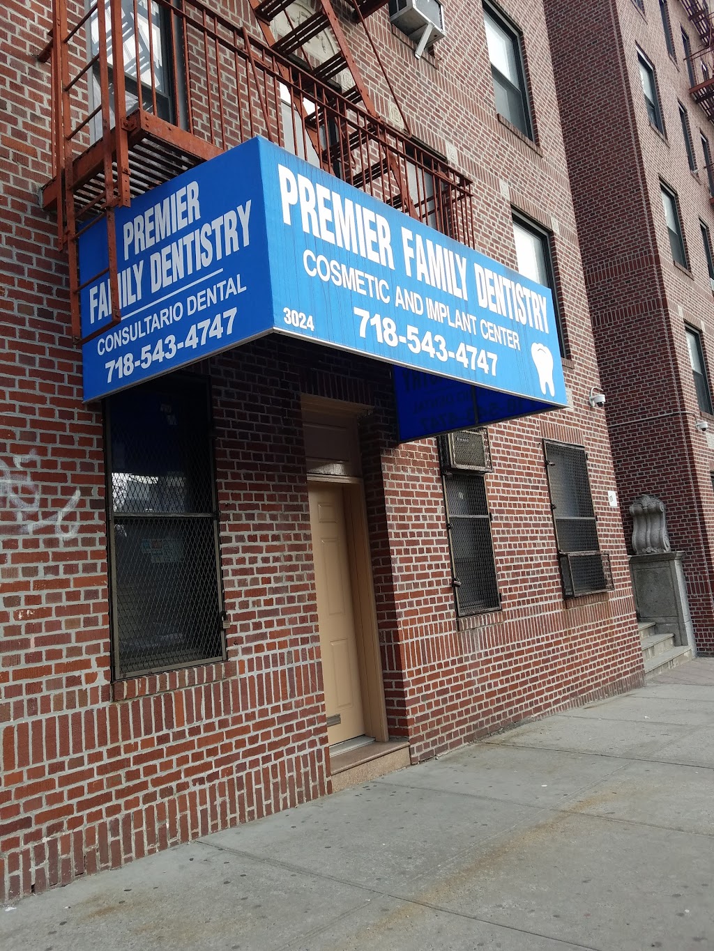 Premier Family Dentistry | 3024 Kingsbridge Ave, The Bronx, NY 10463, USA | Phone: (718) 543-4747