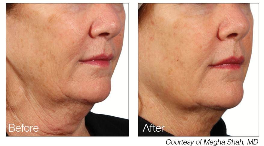 Ageless Beauty Skincare Clinic | 44121 Harry Byrd Hwy STE 285, Ashburn, VA 20147, USA | Phone: (571) 352-9294