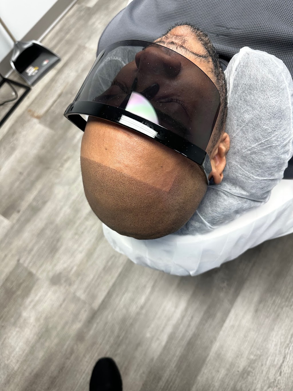 SCALP MICROPIGMENTATION | 2111 W Lincoln Hwy, Merrillville, IN 46410, USA | Phone: (630) 486-4502