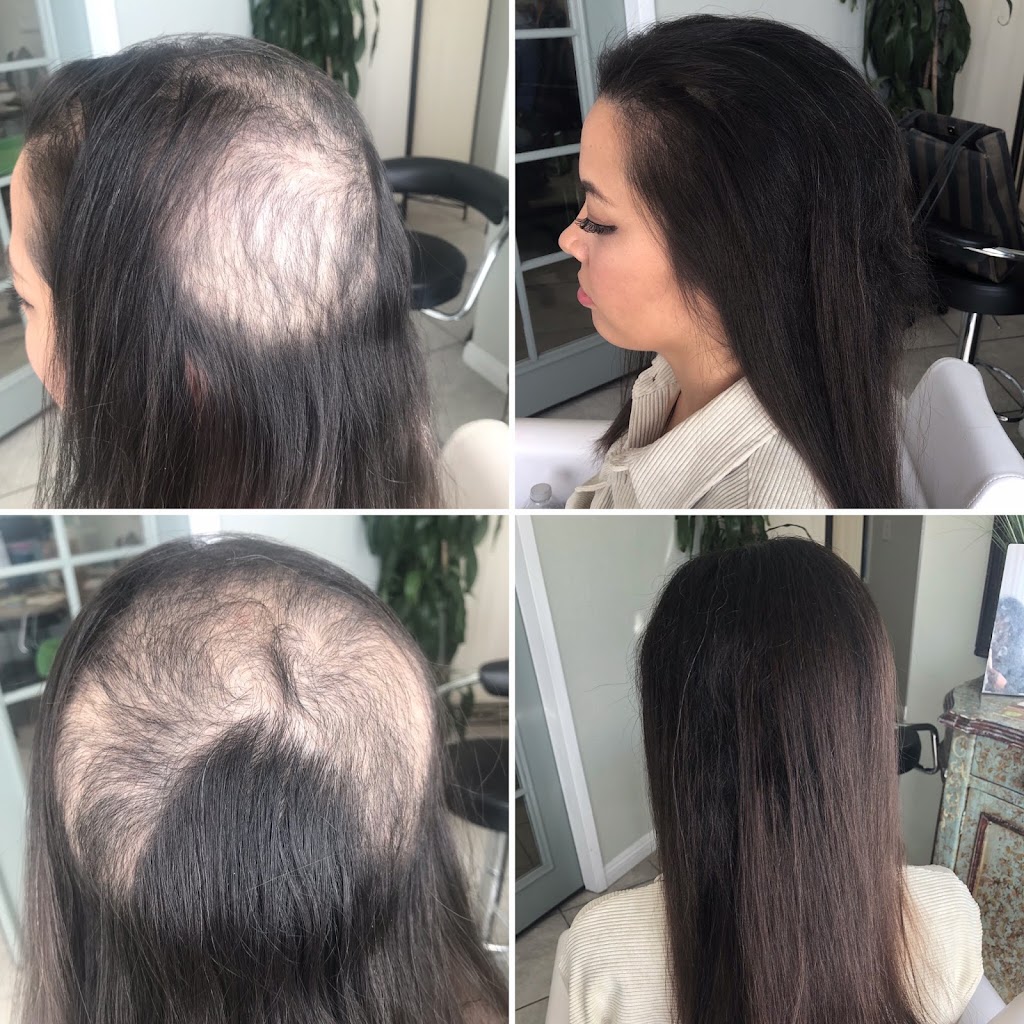 Hair Recovery Treatment Center | 1523 S La Cienega Blvd, Los Angeles, CA 90035 | Phone: (424) 600-8484