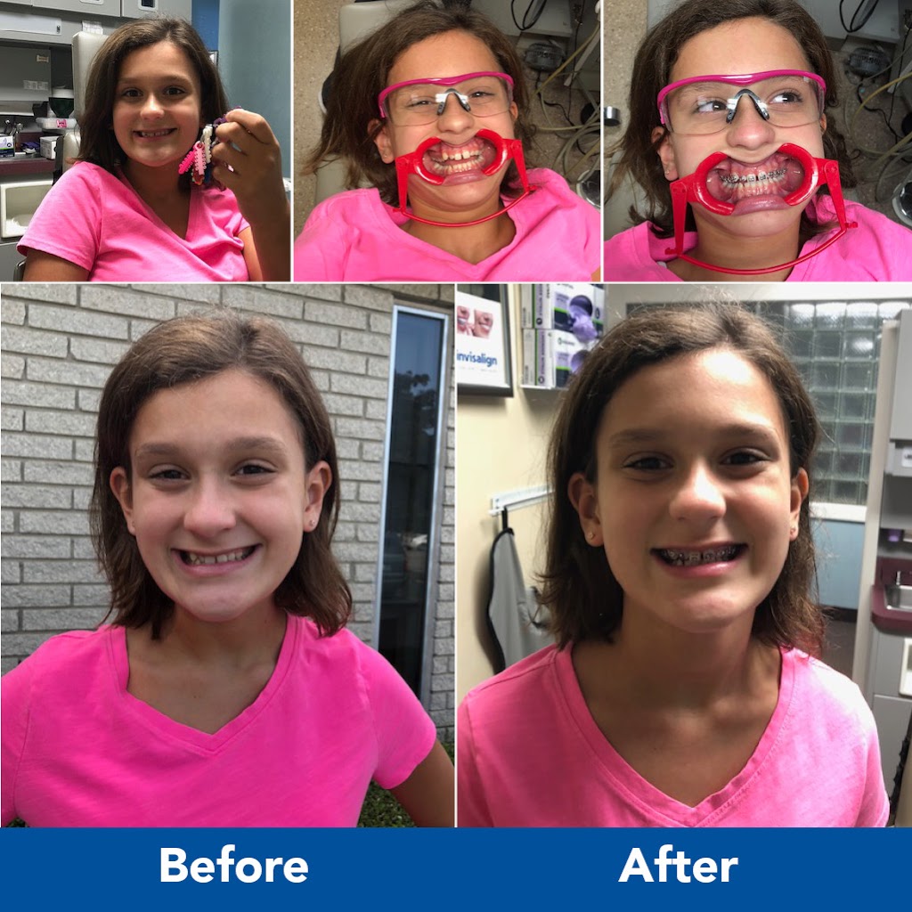 Great Expressions Dental Centers - Toledo | 5950 Airport Hwy Suite 10, Toledo, OH 43615 | Phone: (419) 324-7713