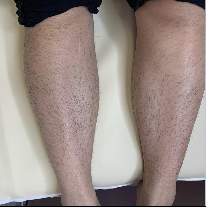 Dream Esthetics | 740 Texas St, Fairfield, CA 94534, USA | Phone: (707) 631-3583