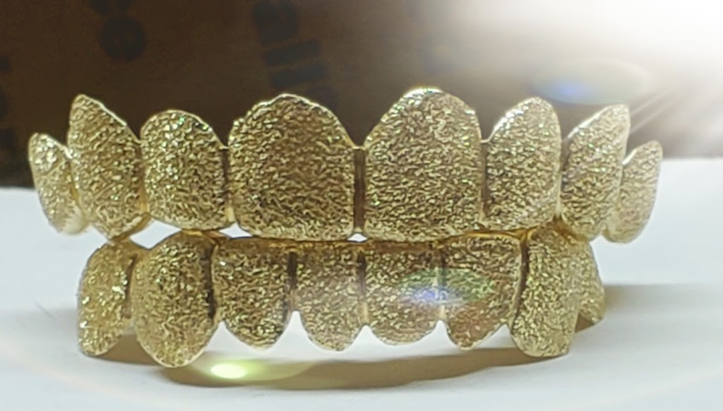 WG Gold Grillz | 10300 SW 72nd St # 280, Miami, FL 33173 | Phone: (786) 712-9299