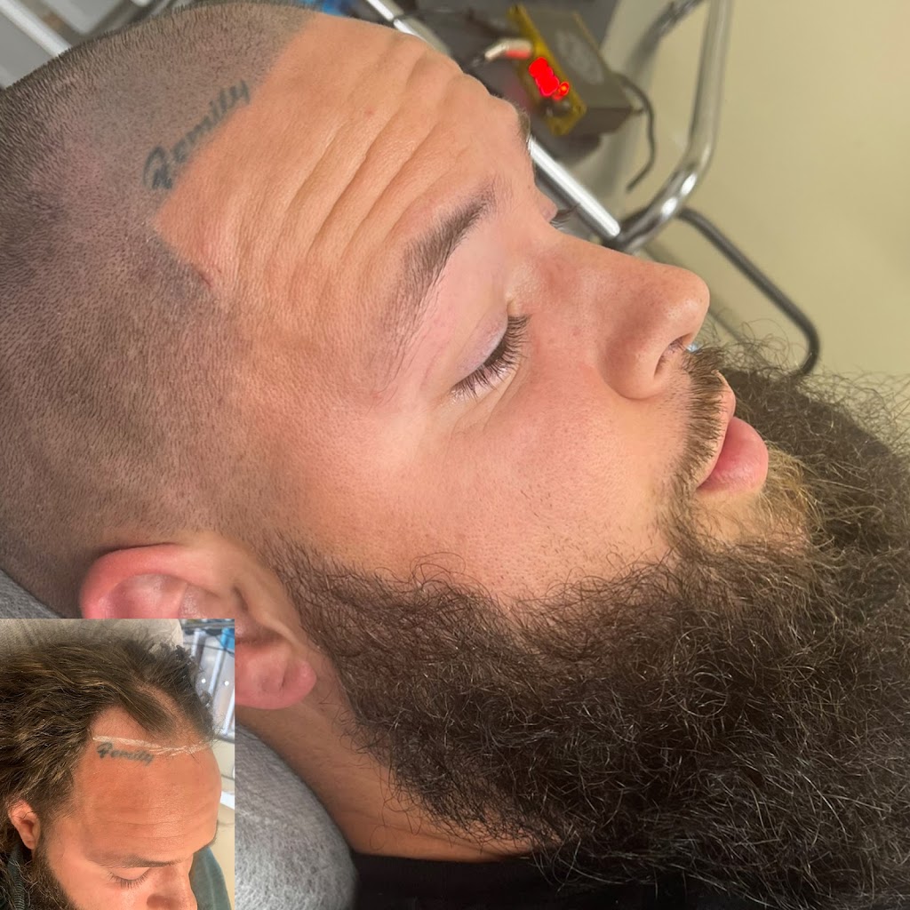 Paramedical Pigments Beauty Co. - Scalp Micropigmentation studio & Day Spa | second floor, 1329 E Kemper Rd Suite 4218 F, Cincinnati, OH 45246 | Phone: (513) 641-8516