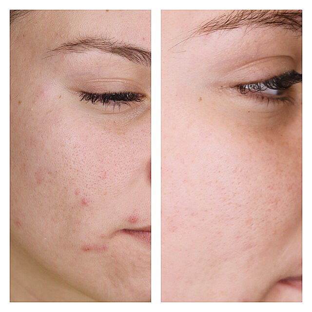 Luminous Glow Skin & Laser | 19669 W Avalon Dr, Buckeye, AZ 85396, USA | Phone: (623) 200-2828