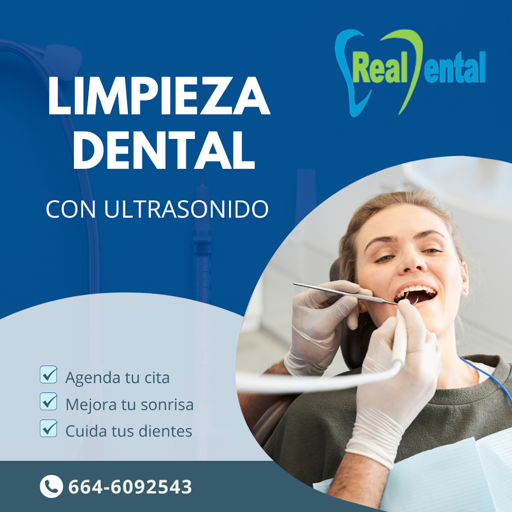 Real Dental Tijuana | Ignacio Manuel Altamirano 4567, Soler, 22530 Tijuana, B.C., Mexico | Phone: 664 609 2543