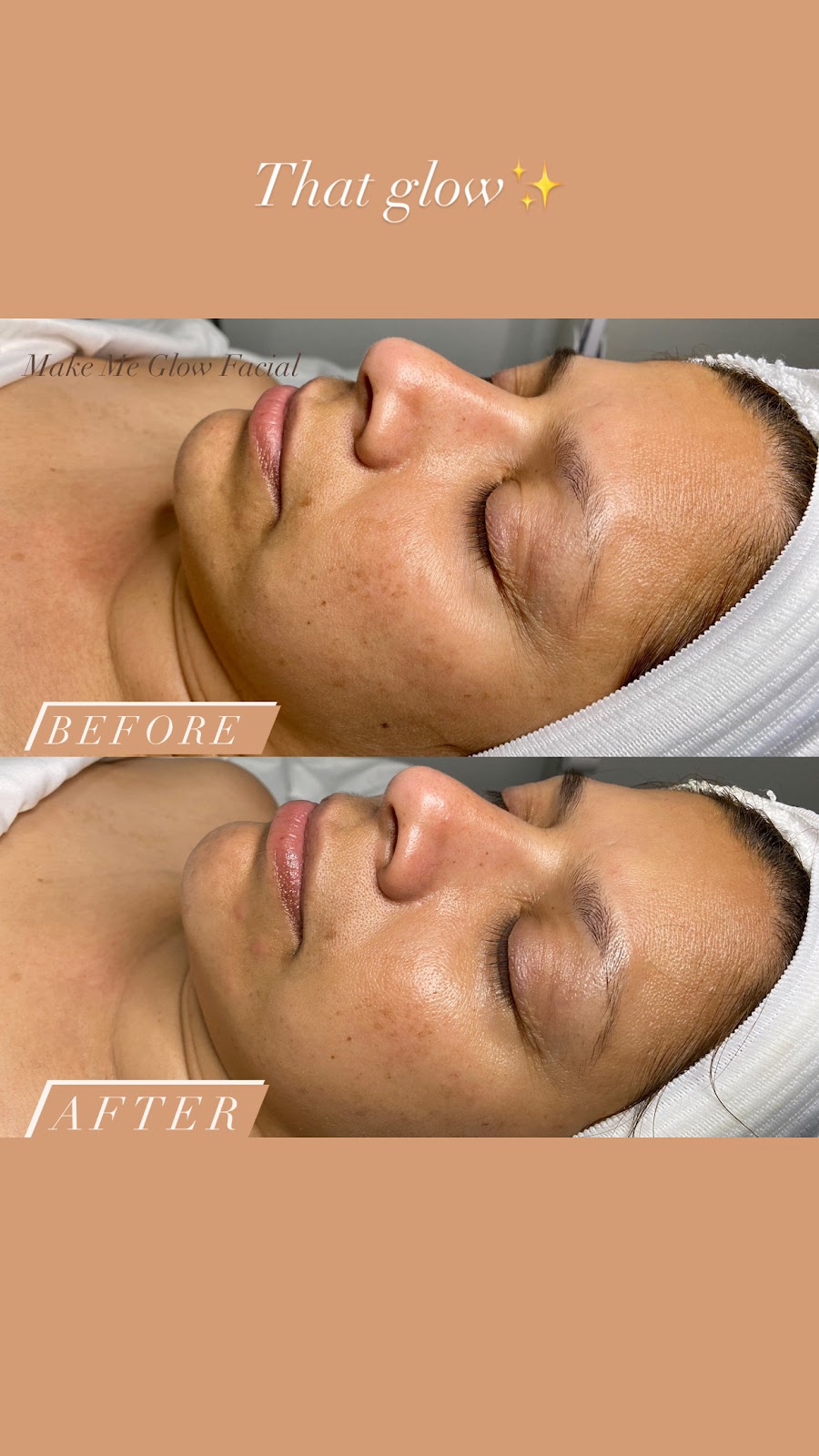 Skin By V | 948 N Mountain Ave #111, Ontario, CA 91762, USA | Phone: (951) 547-9257
