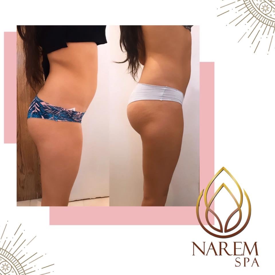 Narem Spa | Blvd. Fundadores 450, 21478 Tecate, B.C., Mexico | Phone: 665 150 8904