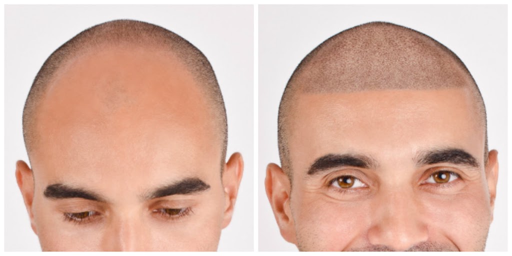 Complete Micropigmentation | 10451 W Palmeras Dr #209E, Sun City, AZ 85373, USA | Phone: (623) 383-3106