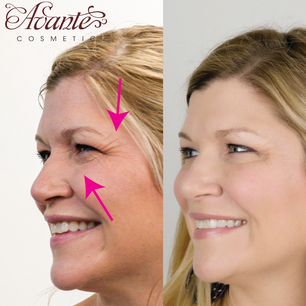 Avante Cosmetic | 9035 Wadsworth Pkwy #3650, Westminster, CO 80021 | Phone: (720) 352-4447