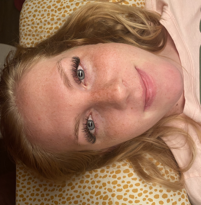 Luna Sol Aesthetics | 11407 US-301, Belleview, FL 34420, USA | Phone: (727) 318-3922